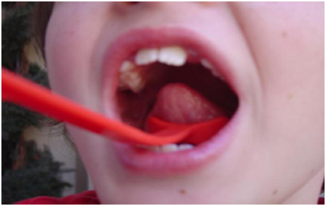 Elevador de Lengua (Tongue Lifter) (Fabricado en Estados Unidos) - Imagen 2